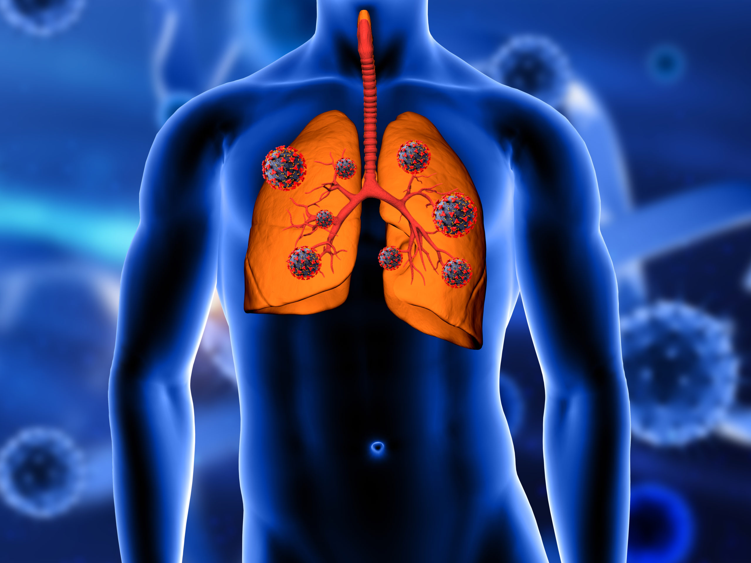 What is Interstitial Lung Disease & Diagnosis of Interstitial Lung Disease – Dr Asha M.A. Mangal.