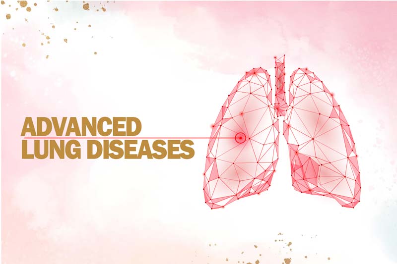 advance lung diseases
